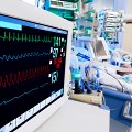 Monitor EKG